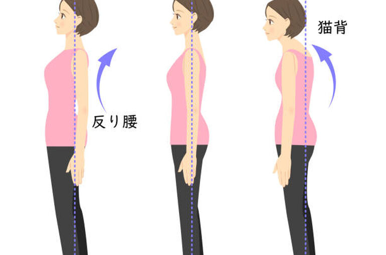 反り腰１